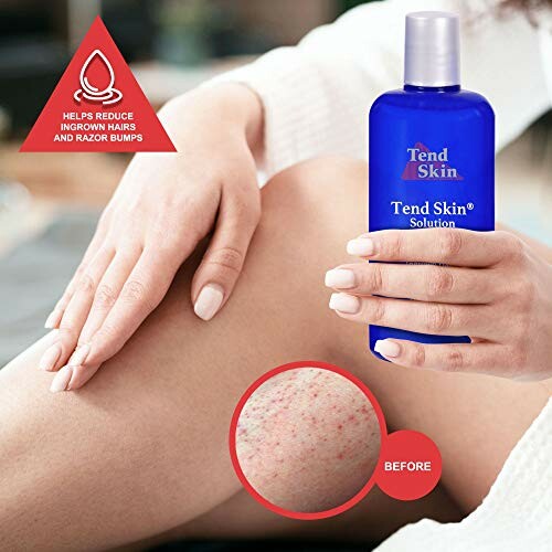 Hand holding Tend Skin Solution bottle near leg with ingrown hair illustration.